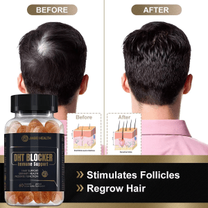 DHT Blocker Gummies showing before and after hair regrowth results, stimulating follicles for healthier hair, ideal for wholesale.